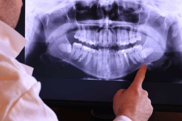 Best Broken or Cracked Tooth Emergency Dentist in Bonham, TX