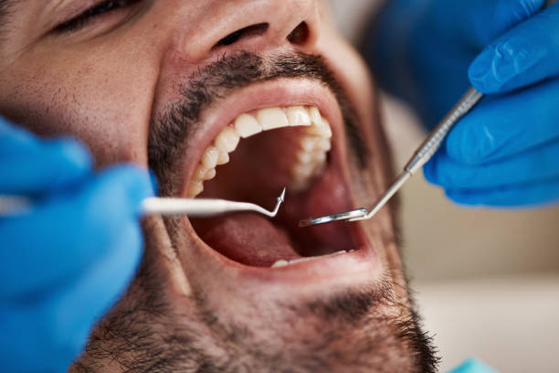 Best Emergency Dental Extractions in Bonham, TX